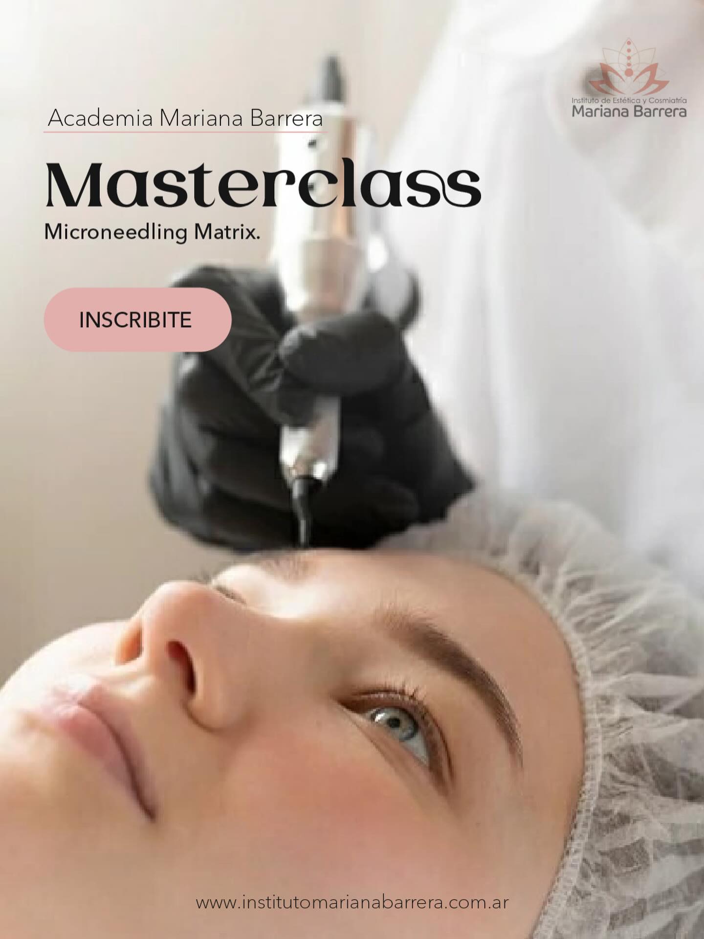Microneedling Matrix - Imagen 2